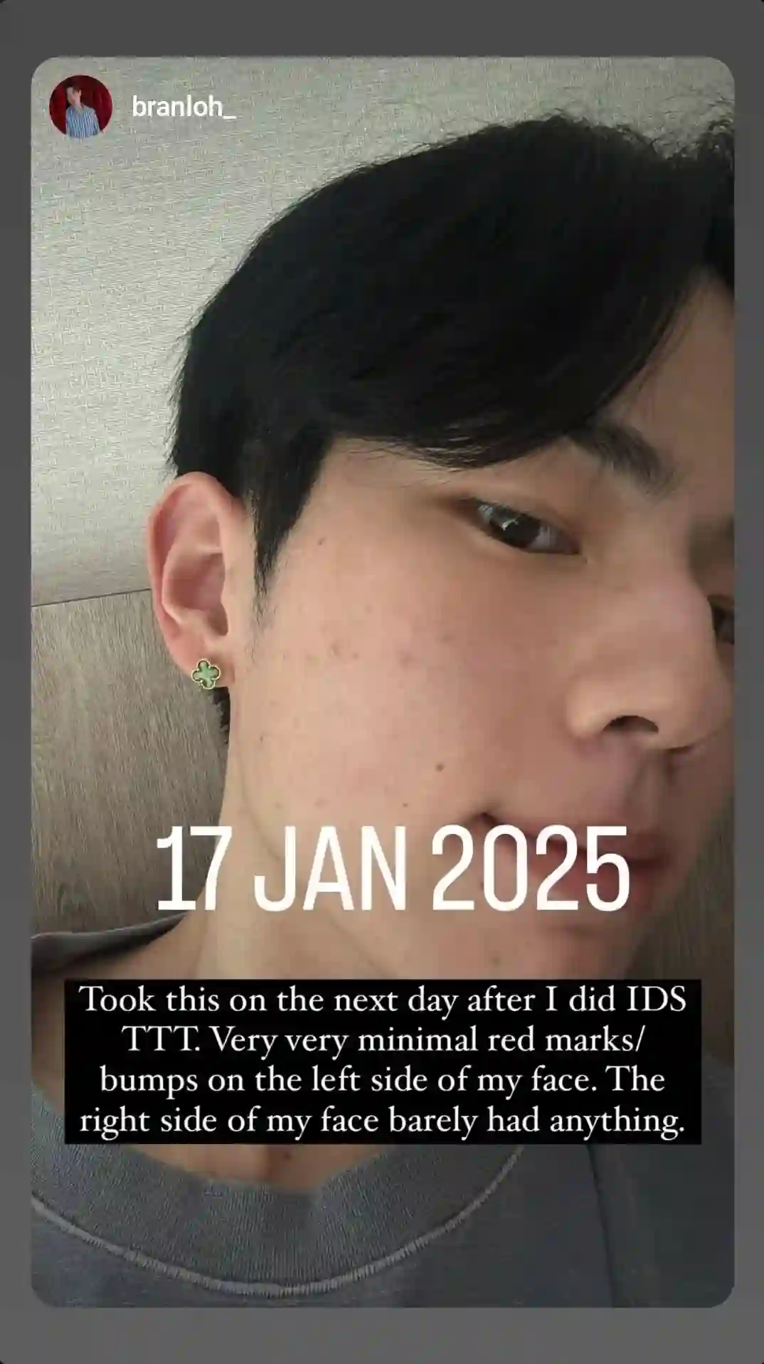 Testimony IDSA 2025 Jan 30