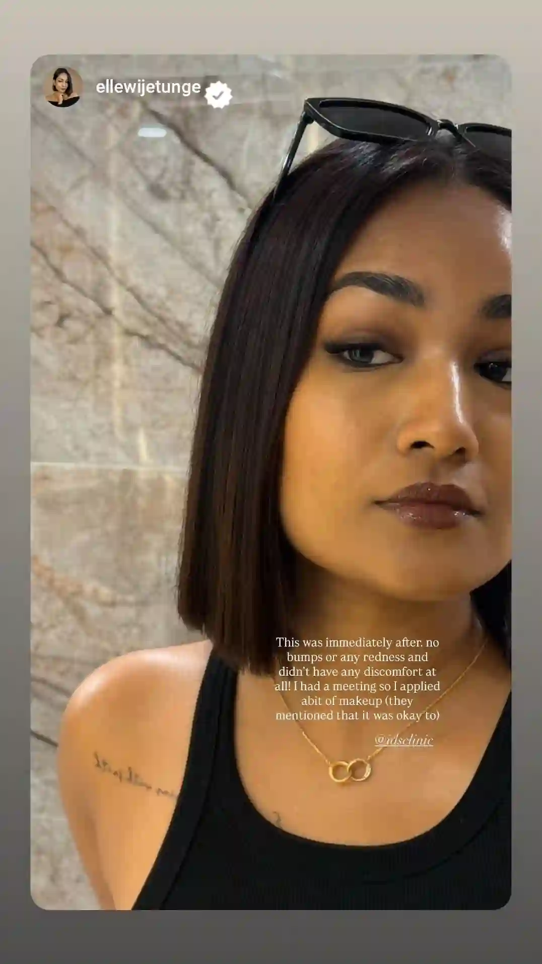 Testimony IDSA 2026 Feb 20